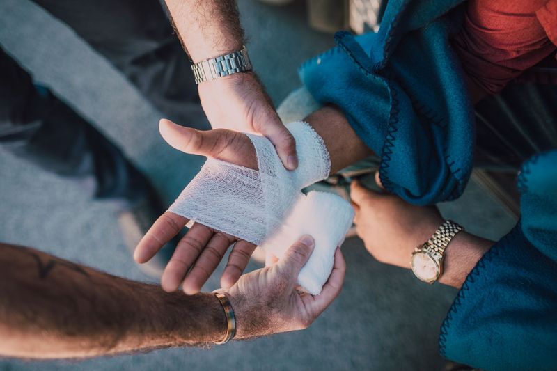 Treating a minor scrape outdoors with EDC first aid kit supplies